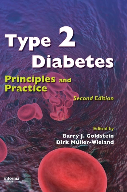 Book cover of: Type 2 Diabetes