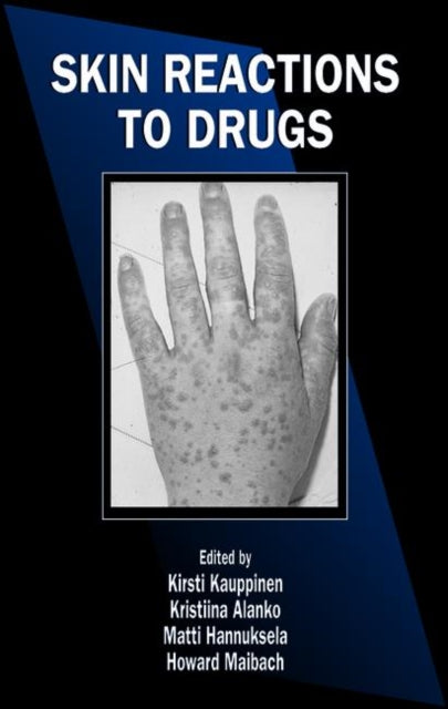 Book cover of: Skin Reactions to Drugs