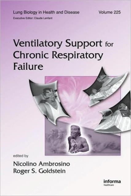 Book cover of: Ventilatory Support for Chronic Respiratory Failure