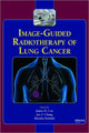 Book cover of: Image-Guided Radiotherapy of Lung Cancer