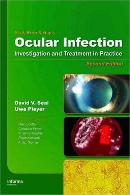 Book cover of: Ocular Infection. By: David Seal