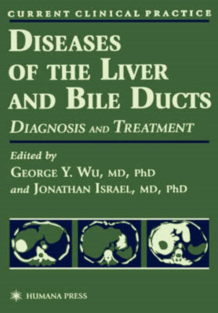 Book cover of: Diseases of the Liver and Bile Ducts
