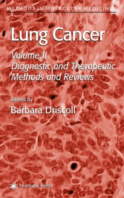Book cover of: Lung Cancer