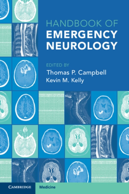 Book cover of: Handbook of Emergency Neurology. By: Thomas P. Campbell