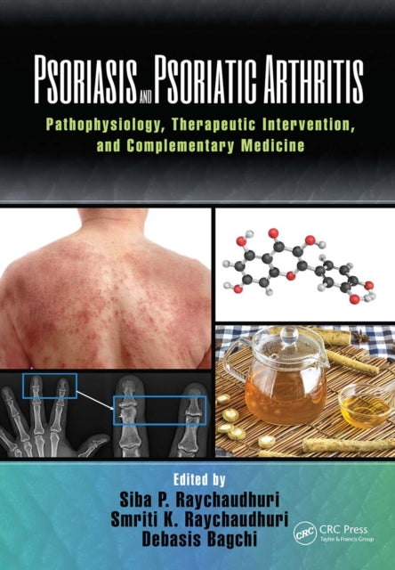 Book cover of: Psoriasis and Psoriatic Arthritis. By: Siba P. Raychaudhuri