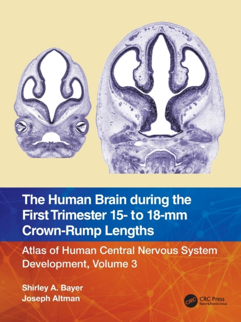 Book cover of: Human Brain during the First Trimester 15- to 18-mm Crown-Rump Lengths. By: Shirley A. Bayer