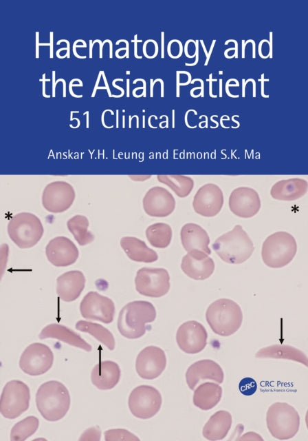 Book cover of: Haematology and the Asian Patient. By: Anskar Y. H. Leung