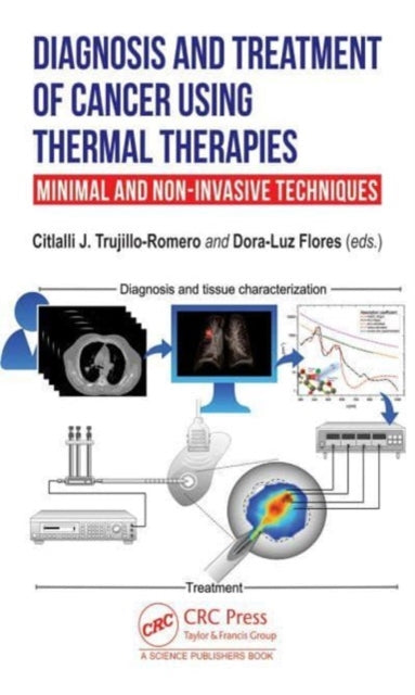Book cover of: Diagnosis and Treatment of Cancer using Thermal Therapies. By: Citlalli J. Trujillo-Romero