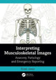 Book cover of: Interpreting Musculoskeletal Images. By: Rosie Jones