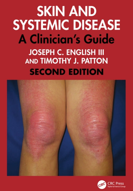 Book cover of: Skin and Systemic Disease