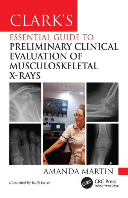 Book cover of: Clark’s Essential Guide to Preliminary Clinical Evaluation of Musculoskeletal X-rays. By: Amanda Martin