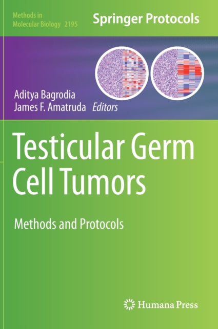 Book cover of: Testicular Germ Cell Tumors. By: Aditya Bagrodia