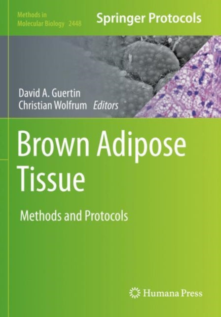 Book cover of: Brown Adipose Tissue. By: David A. Guertin