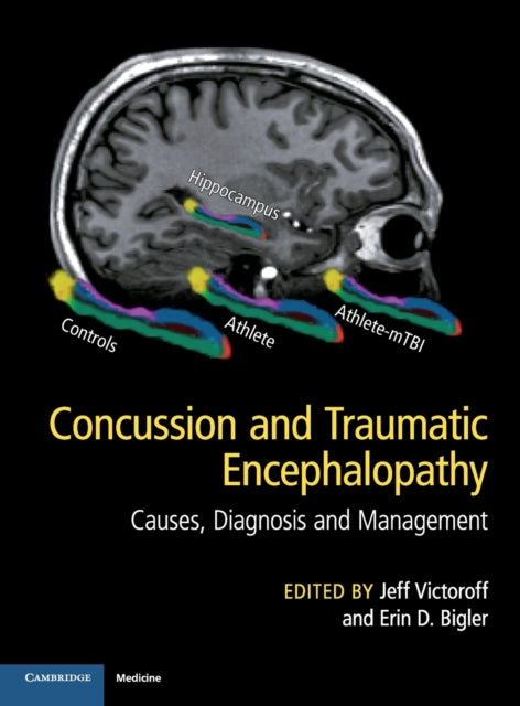 Book cover of: Concussion and Traumatic Encephalopathy. By: Jeff Victoroff