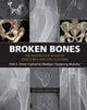 Book cover of: Broken Bones. By: Felix S. Chew