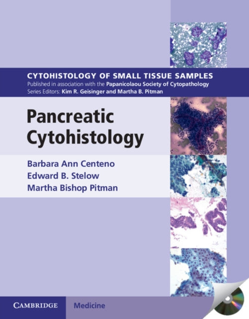 Book cover of: Pancreatic Cytohistology. By: Barbara Ann Centeno