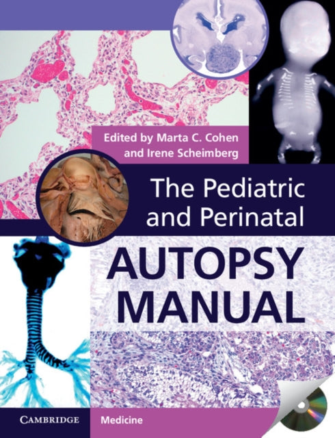 Book cover of: Pediatric and Perinatal Autopsy Manual with DVD-ROM