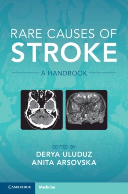 Book cover of: Rare Causes of Stroke. By: Derya Uluduz