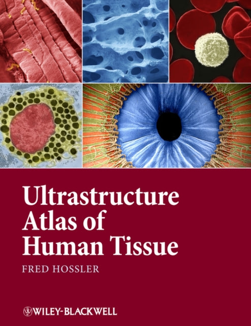 Book cover of: Ultrastructure Atlas of Human Tissues. By: Fred Hossler