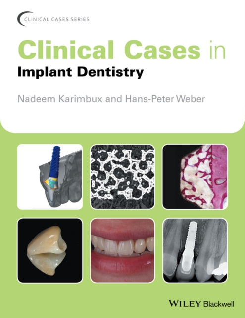 Book cover of: Clinical Cases in Implant Dentistry. By: Nadeem Karimbux