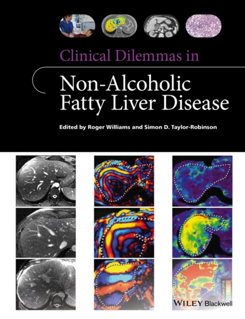 Book cover of: Clinical Dilemmas in Non-Alcoholic Fatty Liver Disease. By: Roger Williams