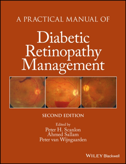Book cover of: Practical Manual of Diabetic Retinopathy Management. By: Peter H. Scanlon