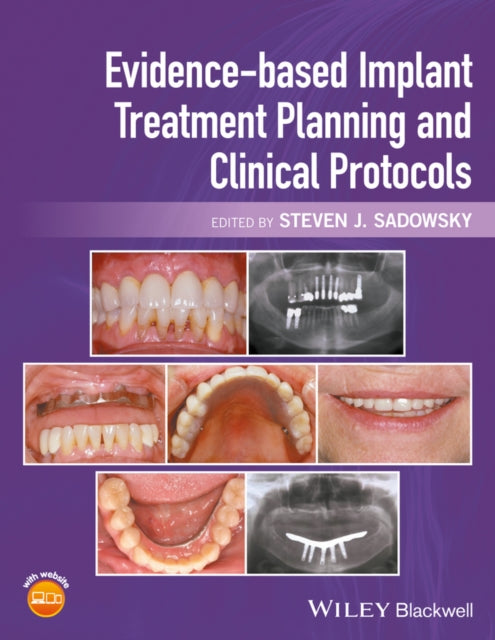 Book cover of: Evidence-based Implant Treatment Planning and Clinical Protocols. By: Steven J. Sadowsky