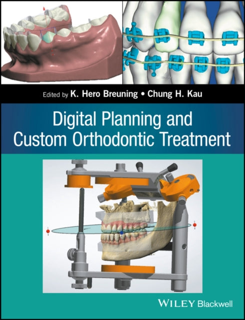 Book cover of: Digital Planning and Custom Orthodontic Treatment. By: Chung How Kau