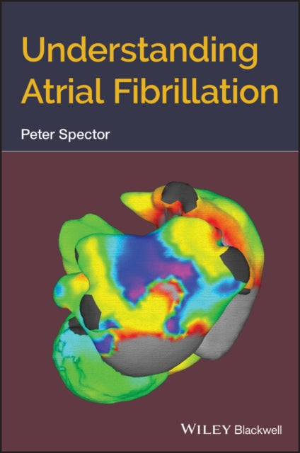 Book cover of: Understanding Atrial Fibrillation. By: Peter Spector