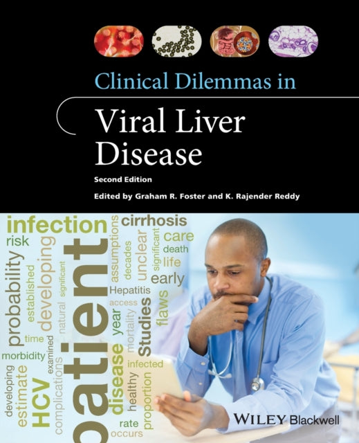 Book cover of: Clinical Dilemmas in Viral Liver Disease. By: K. Rajender Reddy