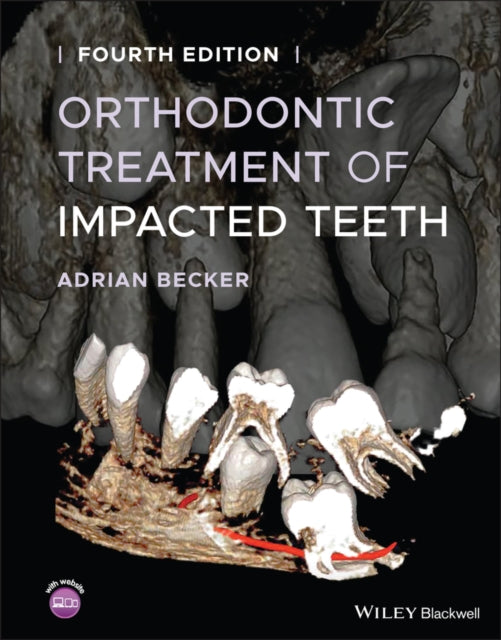 Book cover of: Orthodontic Treatment of Impacted Teeth. By: Adrian Becker