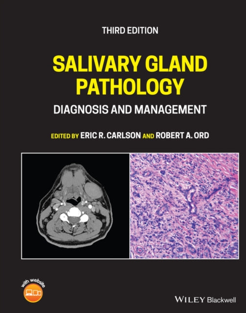 Book cover of: Salivary Gland Pathology. By: Eric R. Carlson