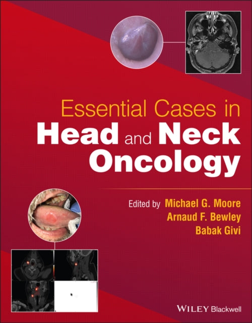 Book cover of: Essential Cases in Head and Neck Oncology. By: Babak Givi