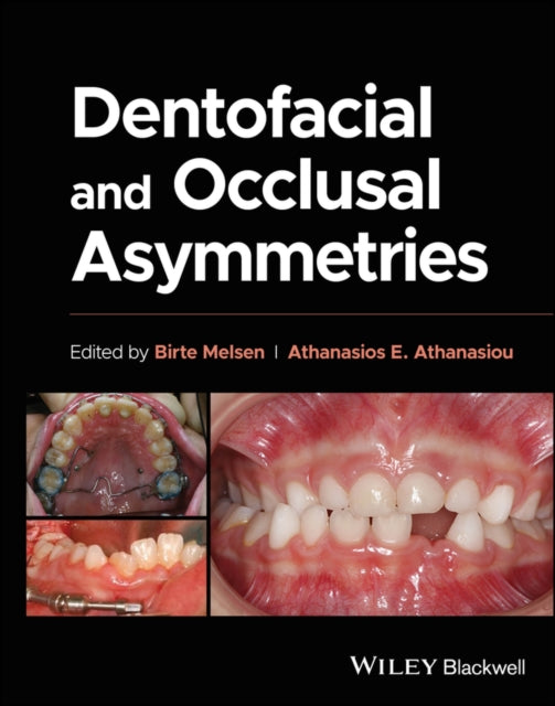 Book cover of: Dentofacial and Occlusal Asymmetries. By: Birte Melsen