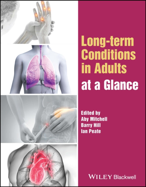 Book cover of: Long-term Conditions in Adults at a Glance. By: Aby Mitchell