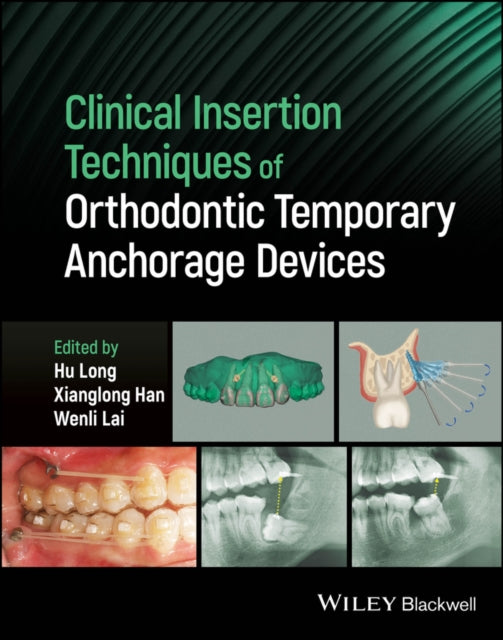 Book cover of: Clinical Insertion Techniques of Orthodontic Temporary Anchorage Devices. By: H. Long