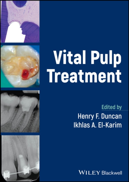Book cover of: Vital Pulp Treatment. By: Henry F. Duncan