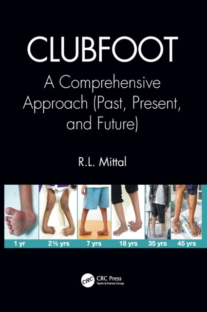 Book cover of: Clubfoot. By: R. L. Mittal