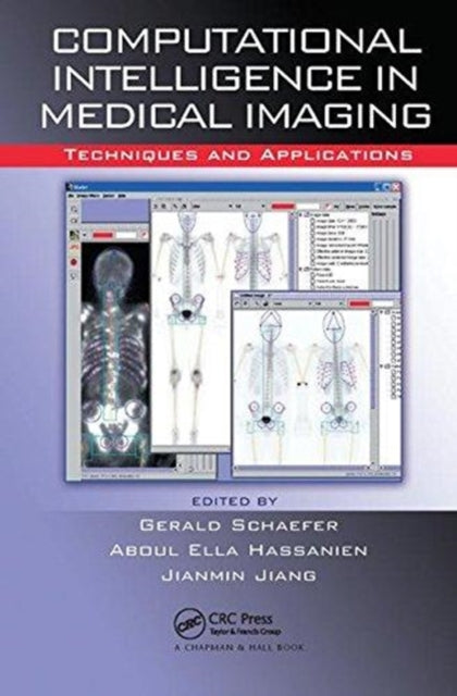 Book cover of: Computational Intelligence in Medical Imaging. By: G. Schaefer