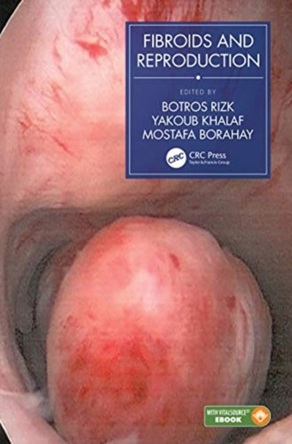 Book cover of: Fibroids and Reproduction. By: Botros Rizk