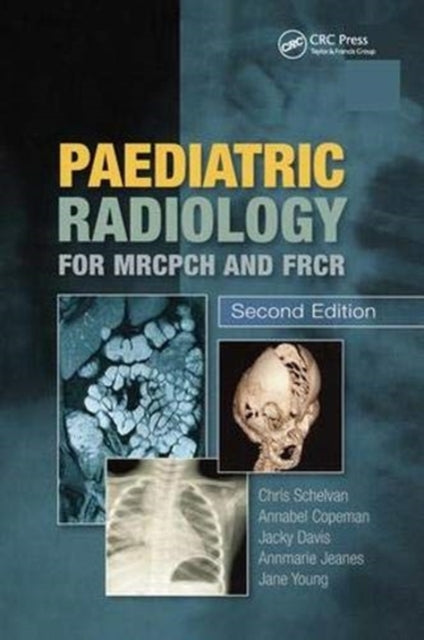 Book cover of: Paediatric Radiology for MRCPCH and FRCR, Second Edition. By: Christopher Schelvan