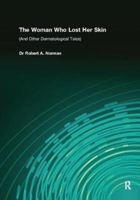 Book cover of: Woman Who Lost Her Skin. By: Rob Norman
