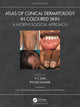 Book cover of: Atlas of Clinical Dermatology in Coloured Skin. By: P. C. Das