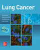 Book cover of: Lung Cancer:  Standards of Care. By: Goetz Kloecker