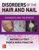 Book cover of: Disorders of the Hair and Nail: Diagnosis and Treatment. By: Antonella Tosti