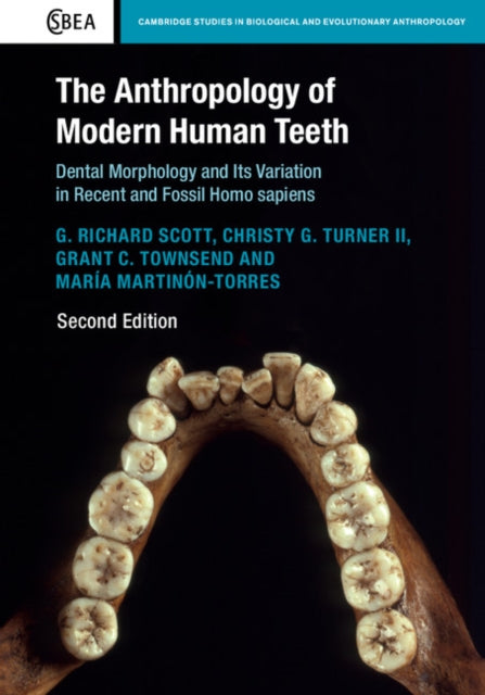 Book cover of: Anthropology of Modern Human Teeth. By: G Richard Scott