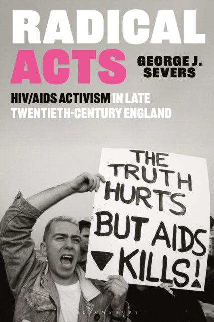 Book cover of: Radical Acts. By: George Severs