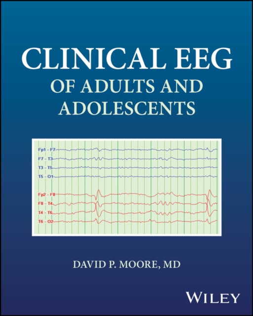 Book cover of: Clinical EEG of Adults and Adolescents. By: David Moore