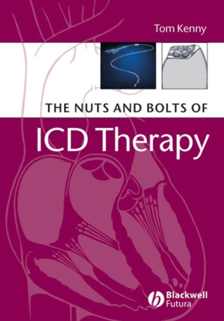 Book cover of: Nuts and Bolts of ICD Therapy. By: Kenny, Tom