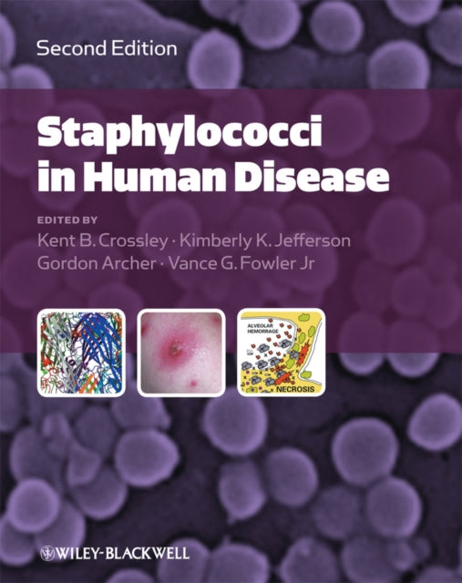 Book cover of: Staphylococci in Human Disease